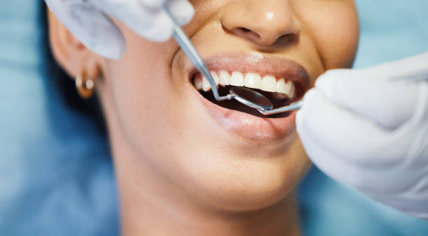 Best Emergency Treatment for Dental Infections or Abscesses in Coldwater, OH