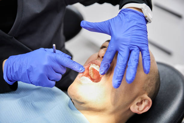 Best Emergency Root Canal Treatment in Coldwater, OH