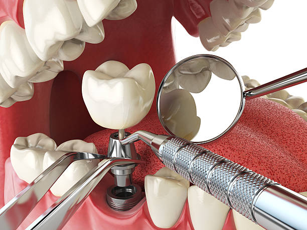 Best Pediatric Emergency Dentist in Coldwater, OH